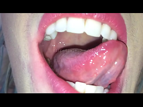 Mouth (Trice) Video 2 Preview