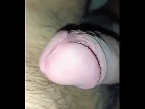 Prostate cum