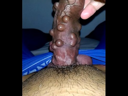 Penile beading