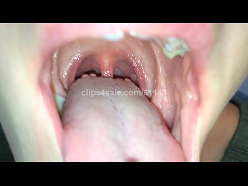 Inside My Mouth (Video 1 Preview)