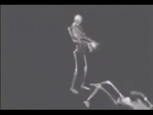 esqueletos