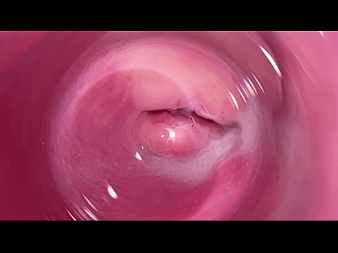 Camera inside vagina