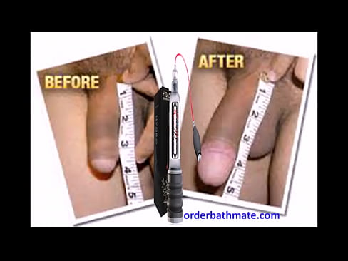 Enlarge Your Penis with Bathmate Pump-Hydromax Pump