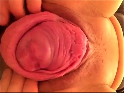 japanese prolapse