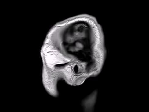 Structural MRI animation