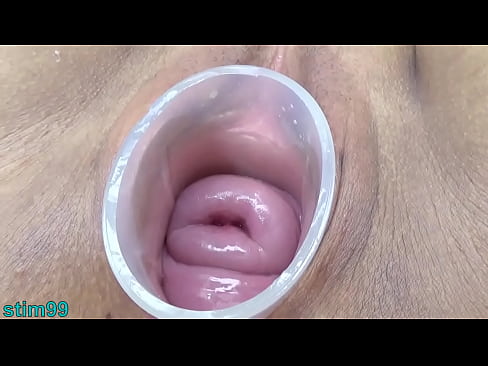 Uncensored Asian Milf Cervix Stretched Open Wide to watch inside the expandided Uterus