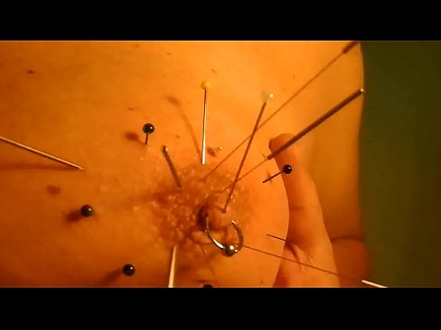 Bad acupuncture