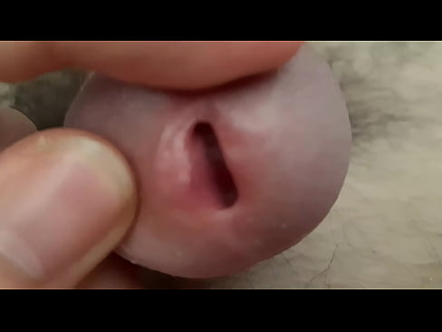 Hairy penis