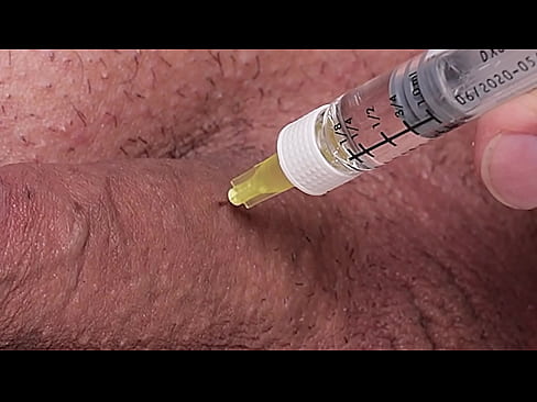 Penile Injection - 2 time to use the medicini