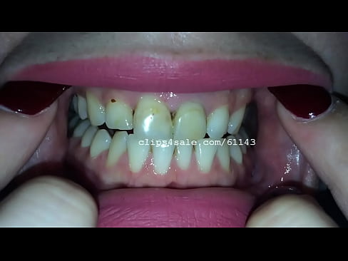Misha Mouth Video3 Preview