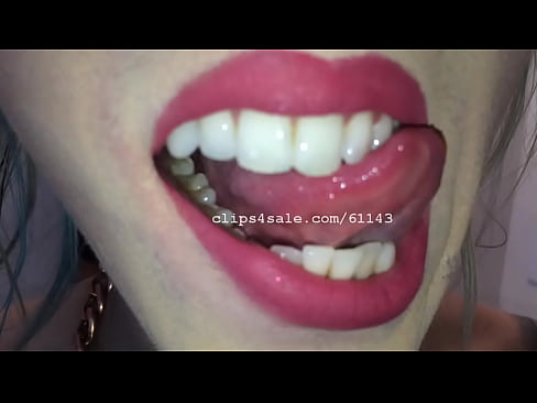 Trice Mouth Video 1