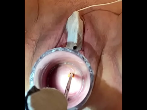 Electrical sounding cervix maximum power