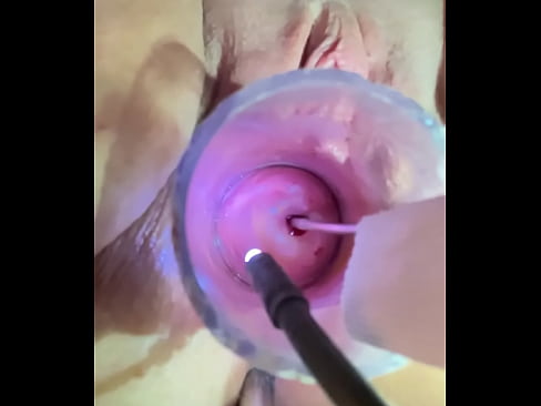 Estim in cervix and ass spasming