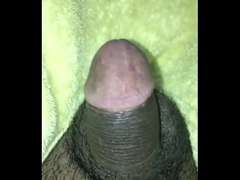 Indian New circumcised penis
