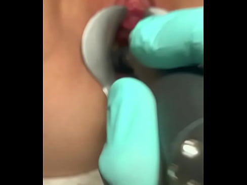 Gynecology induced climax