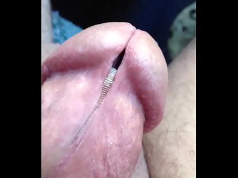 Self meatotomy clamping with cum