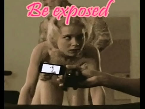 be exposed
