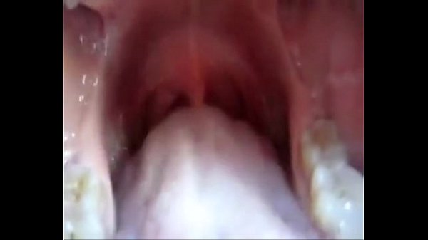 The inside of the mouth