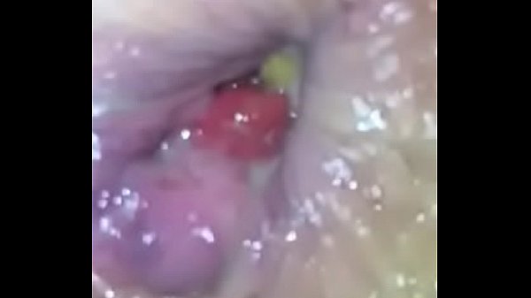 Anal gape girl