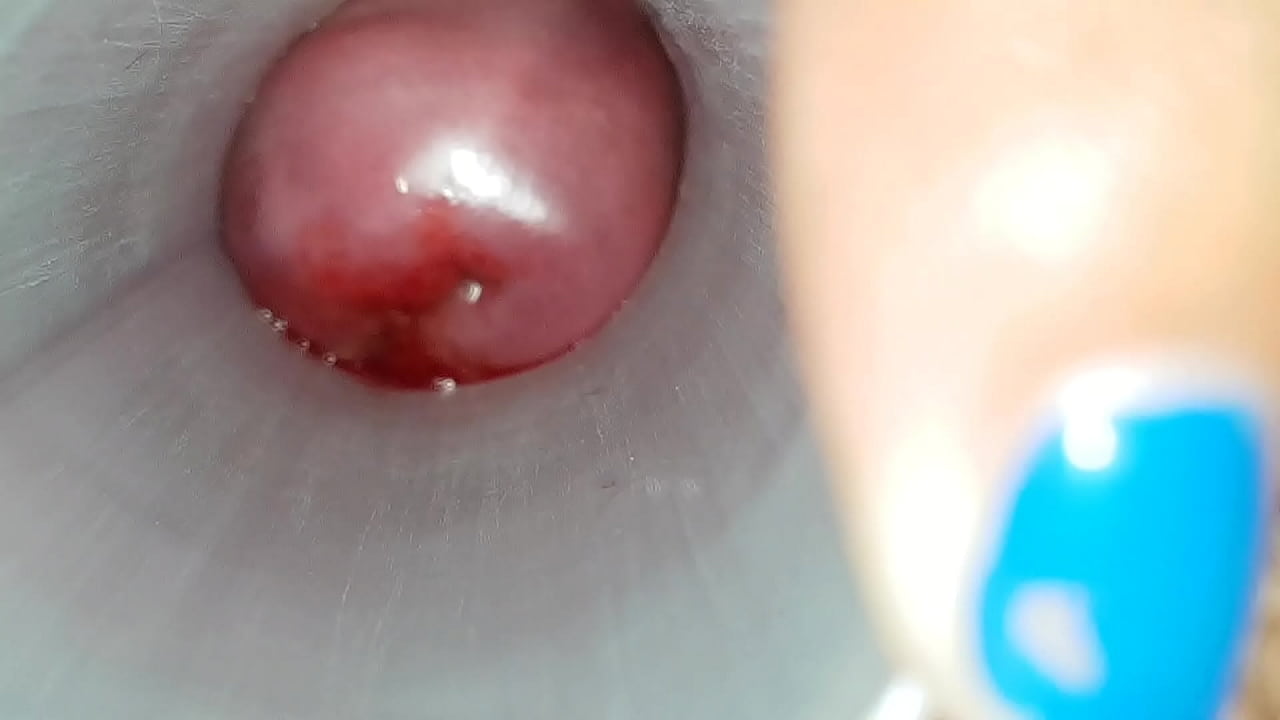 Fucking bogotan cervix 5