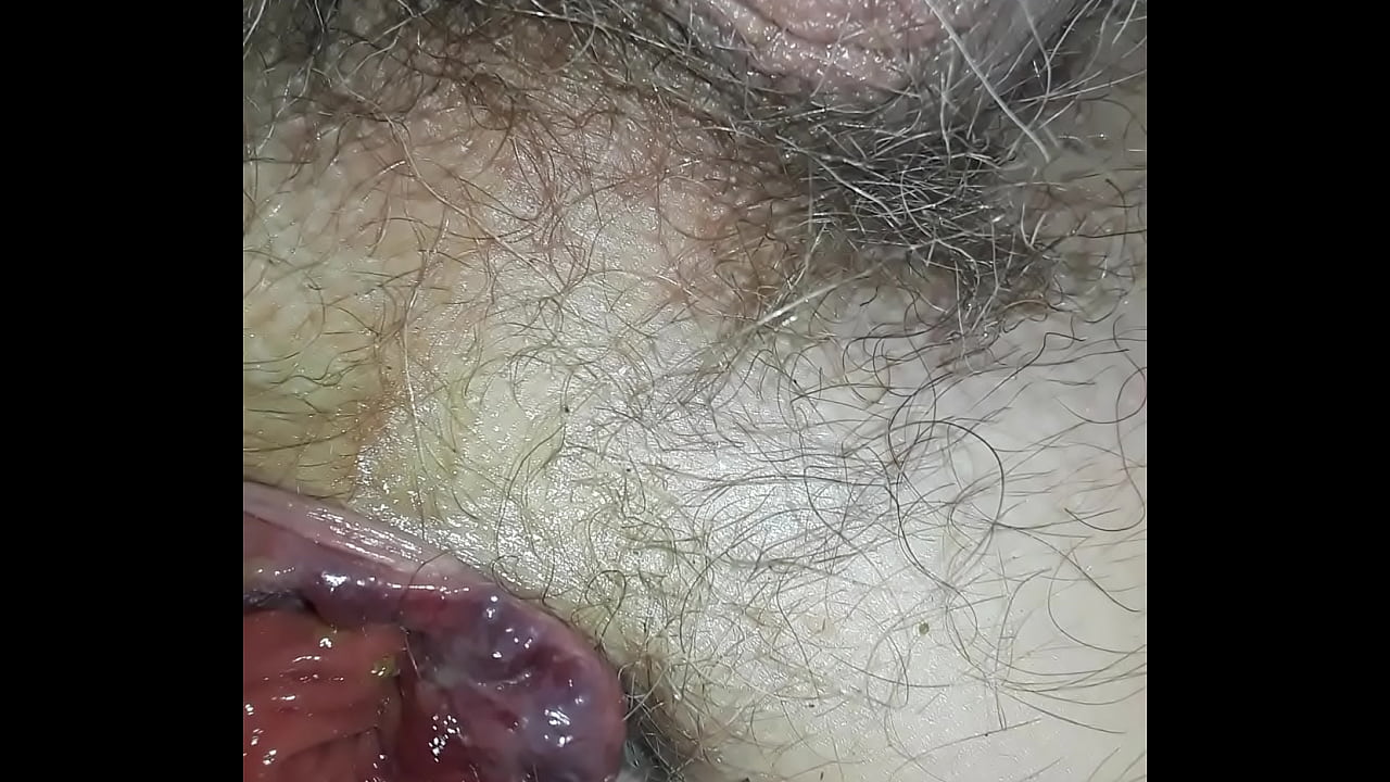 Fucking sexy prolapse