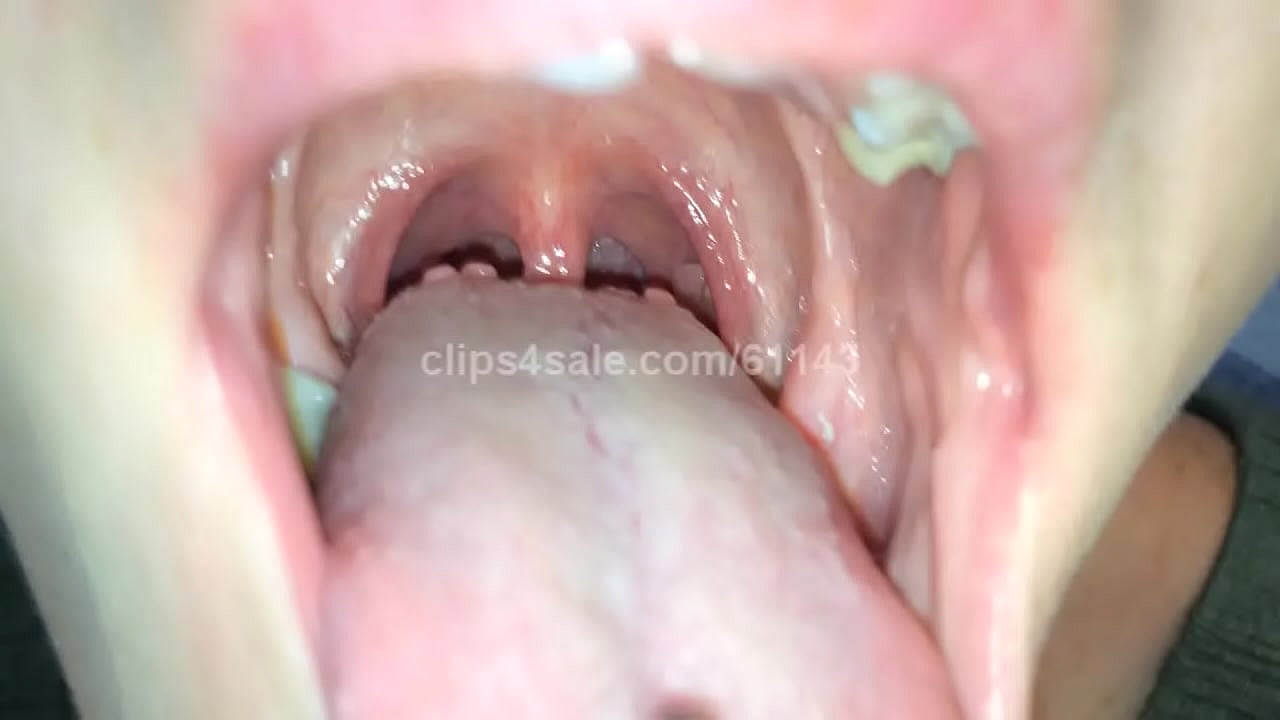 Inside My Mouth (Video 1 Preview)