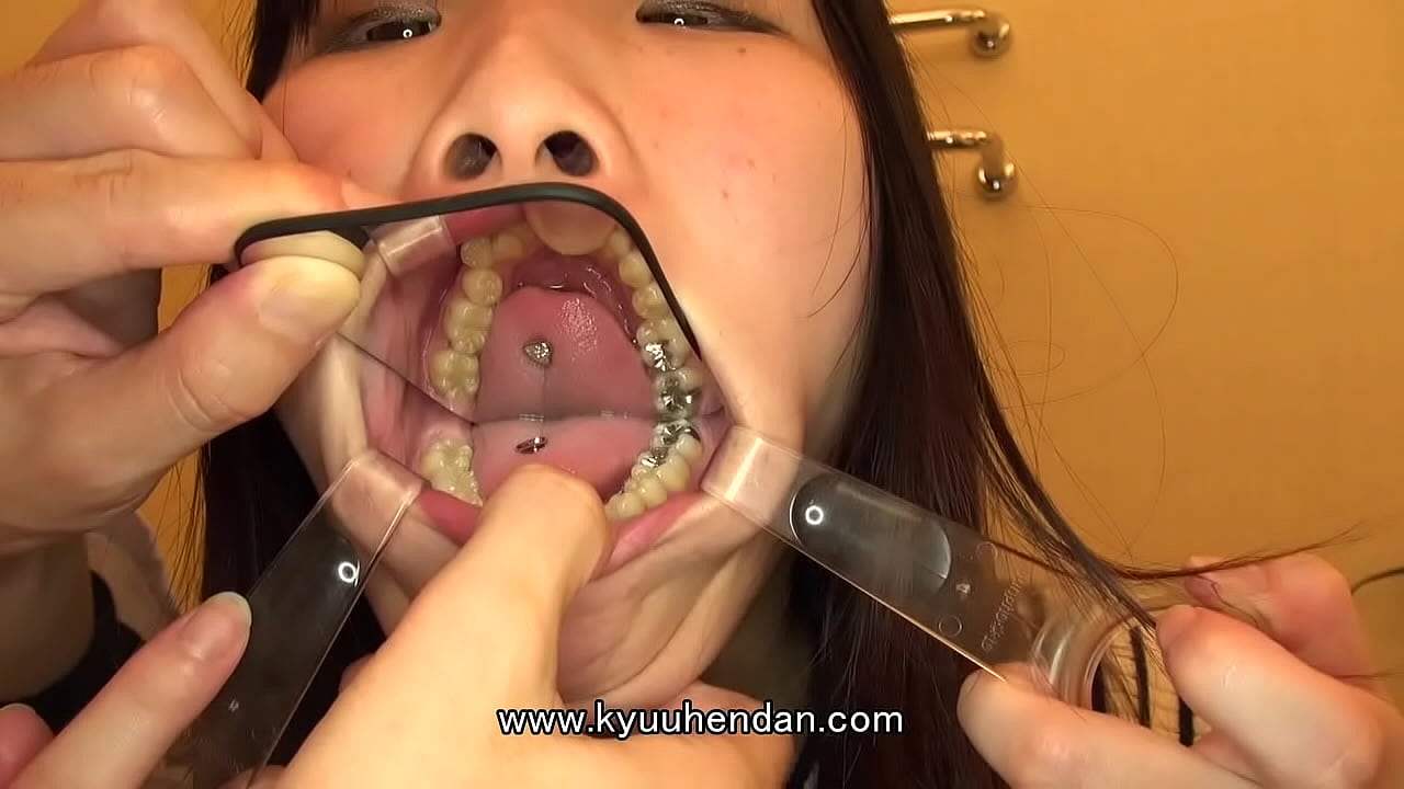 Compilation Tooth Mouth 01