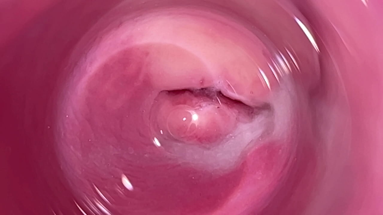 Camera inside vagina