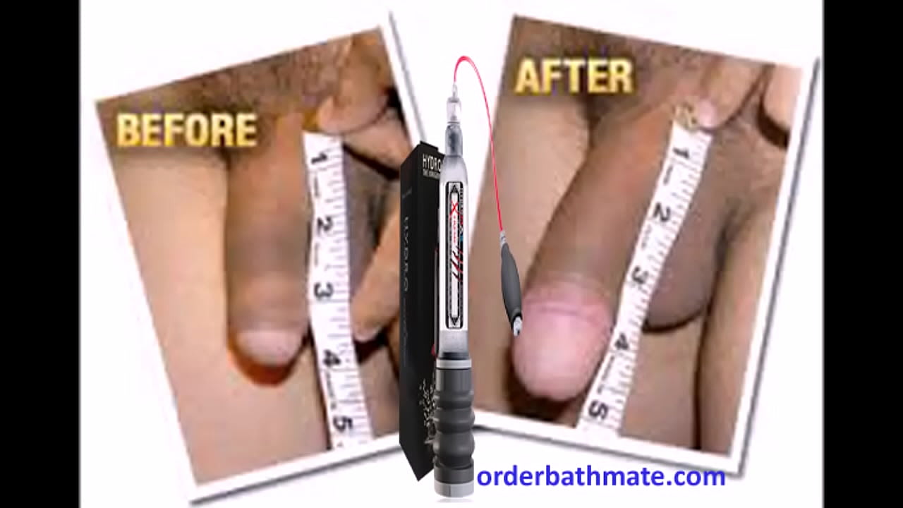 Enlarge Your Penis with Bathmate Pump-Hydromax Pump