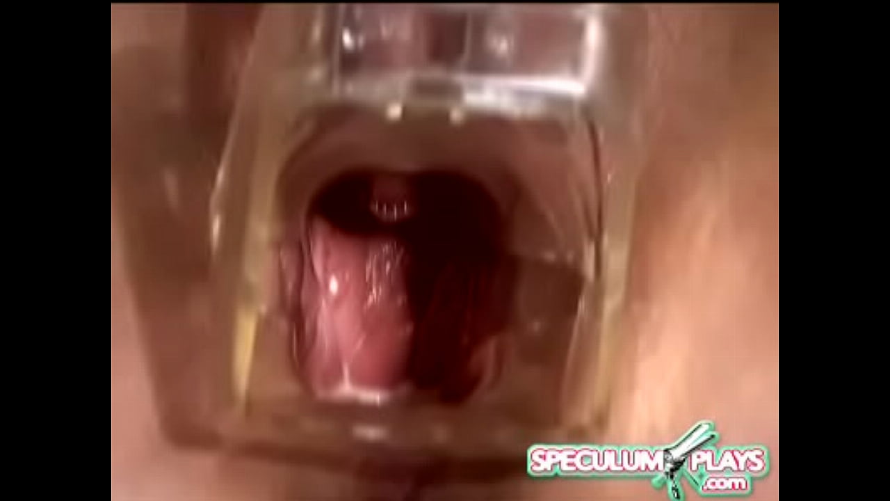 Speculum