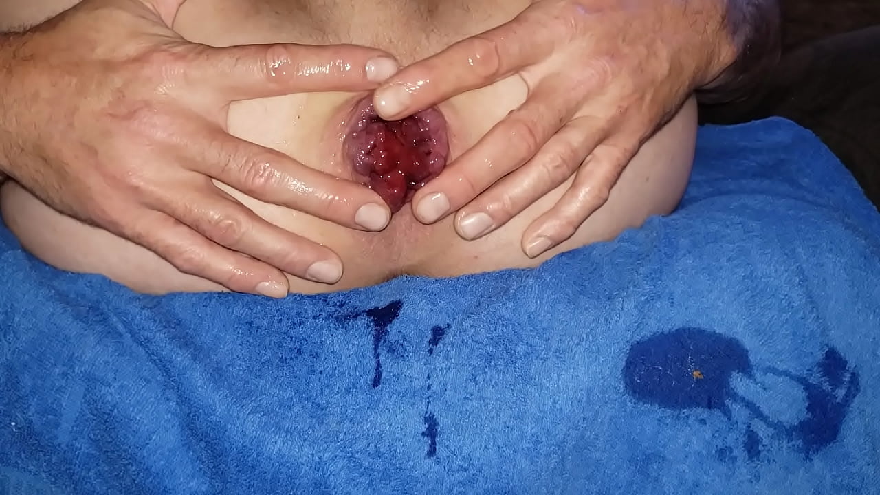 Anal massage with blooming Rosebud