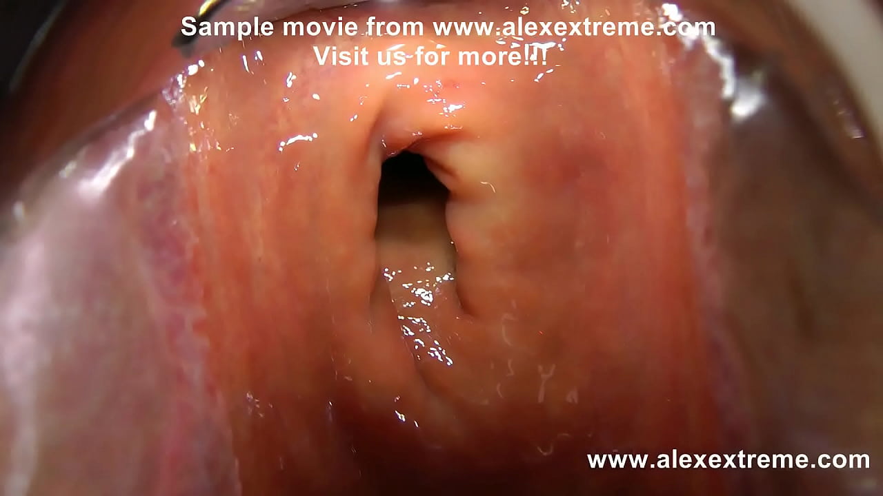 Absolute speculum anal masterpiece!!! Huge gaping hole with amazing view.