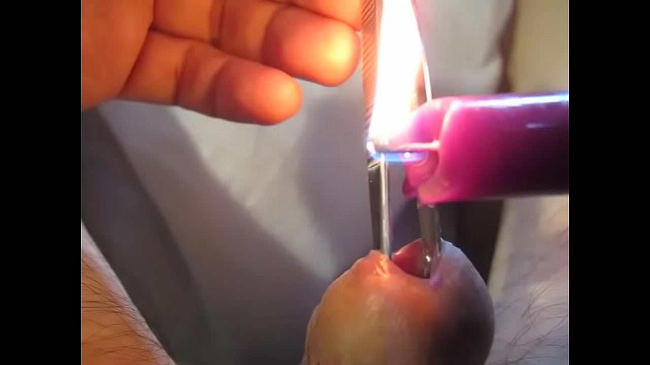 Urethra in hot purple wax