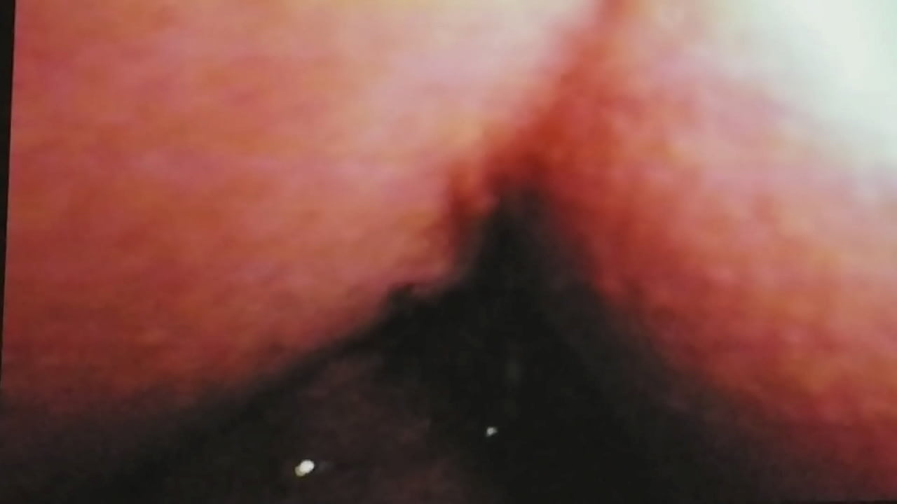 Gaping hairy  anal