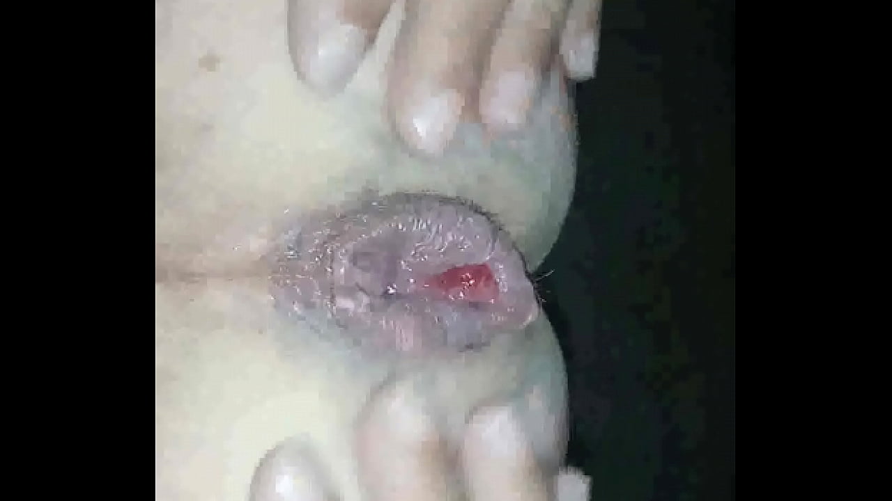 Creampie anal