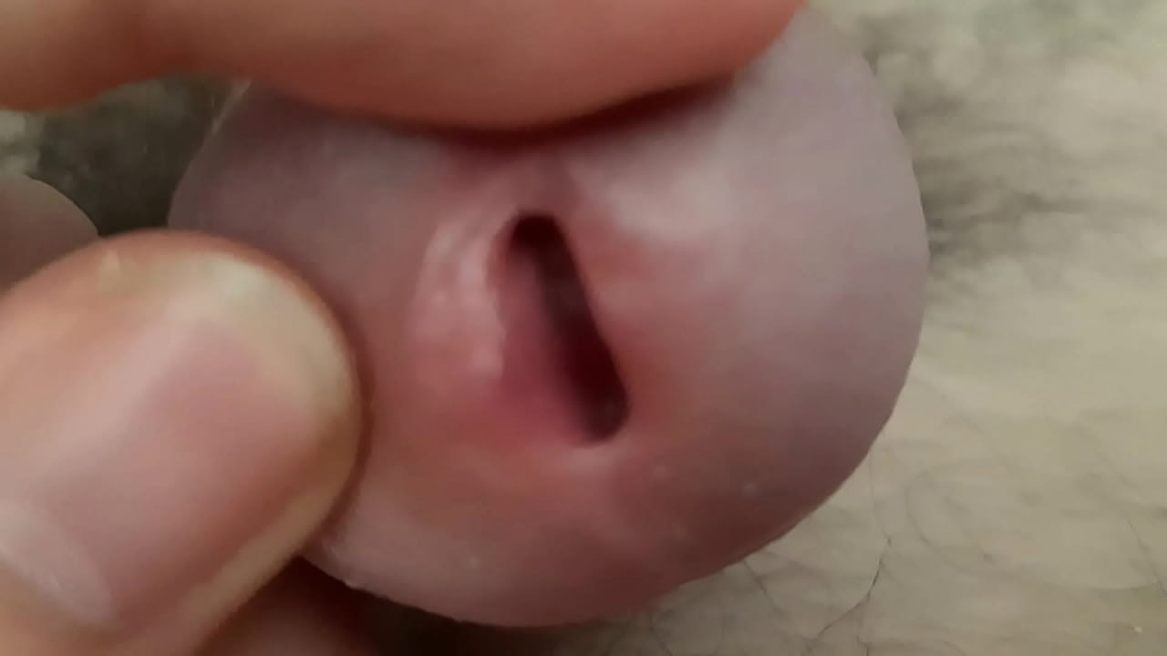 Hairy penis