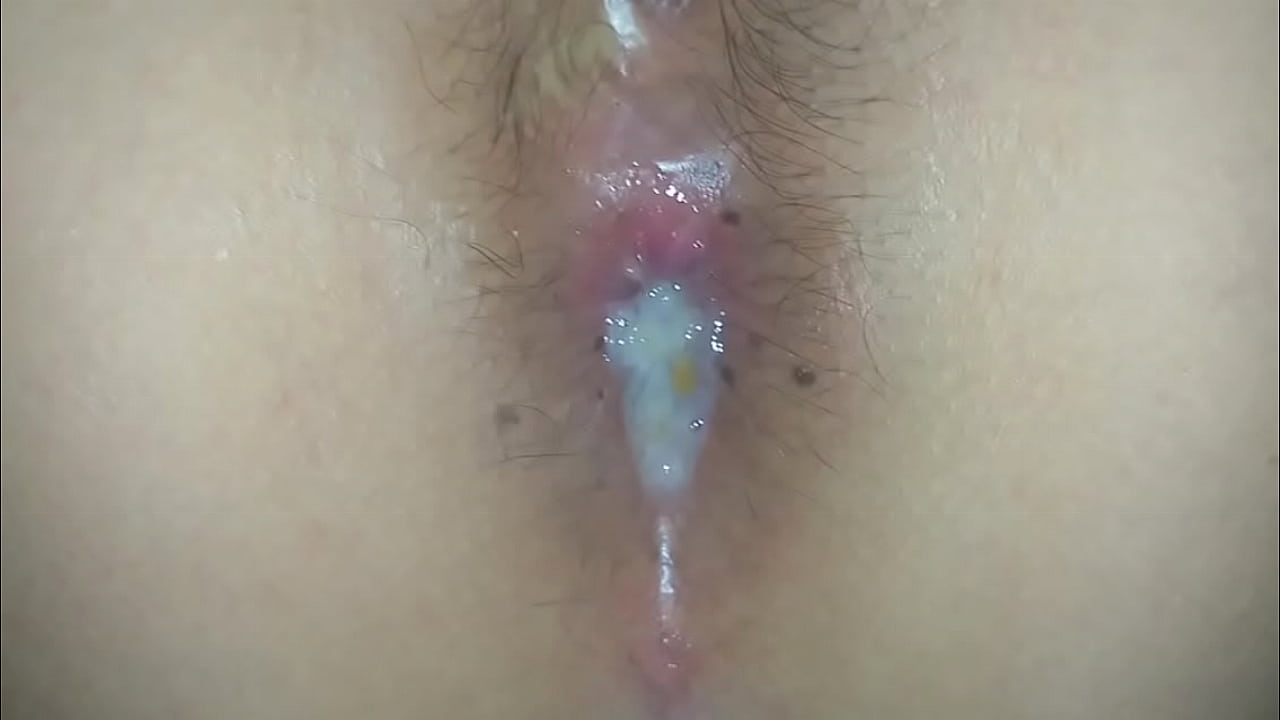 Creampie anal