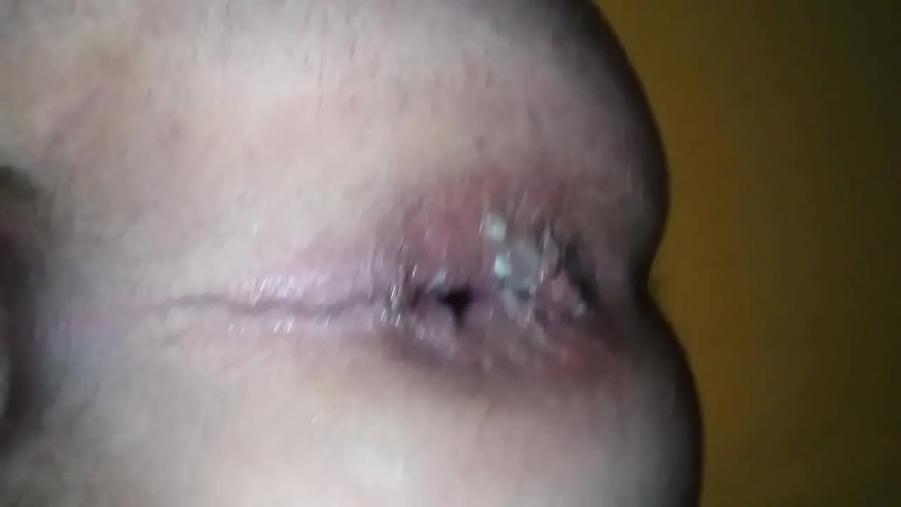 My anal gape