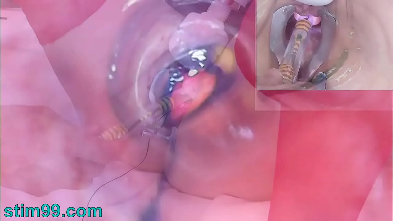 Endoscopic Cam into Milf pee hole with bladder full piss