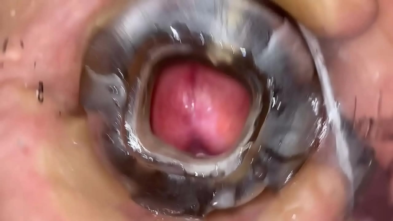 cum fountain