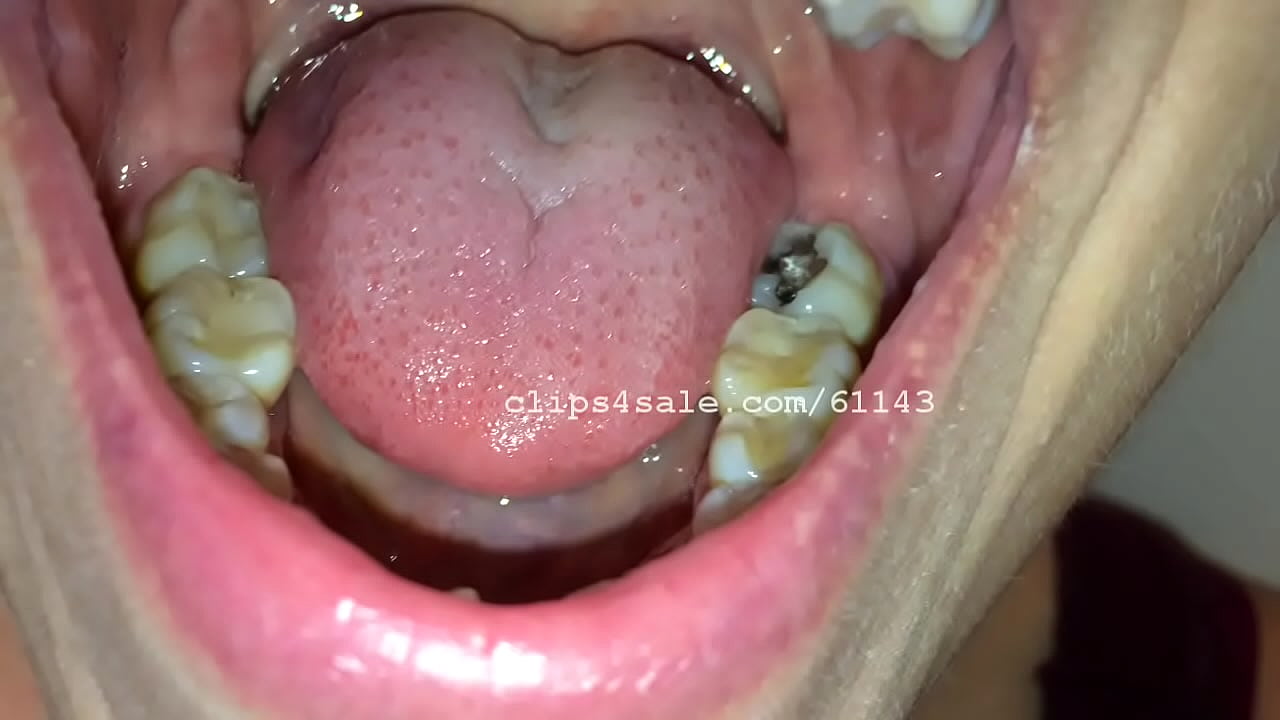 Diana Mouth Part4 Video1