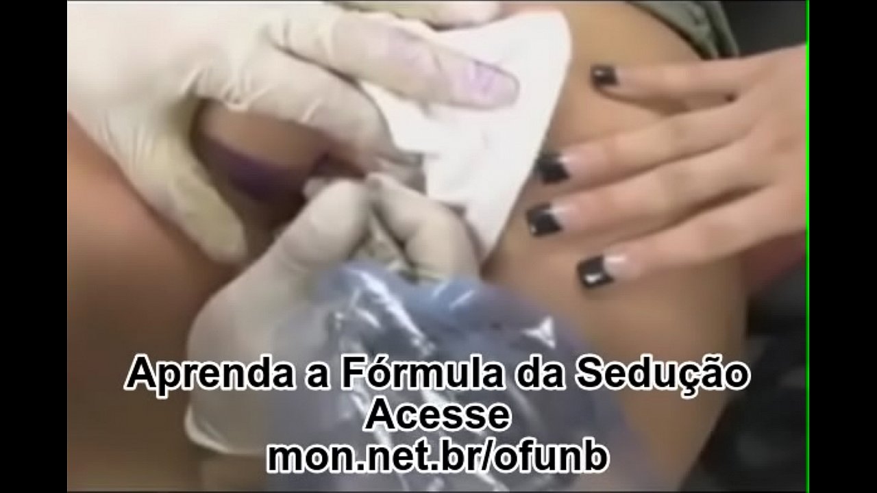 Tatuagem anal quase dá errado kkk