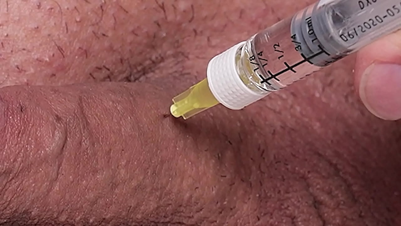 Penile Injection - 2 time to use the medicini