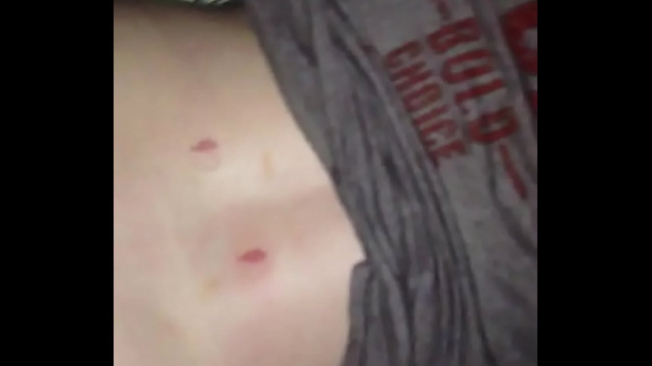 s. woman hickey on back cum shot