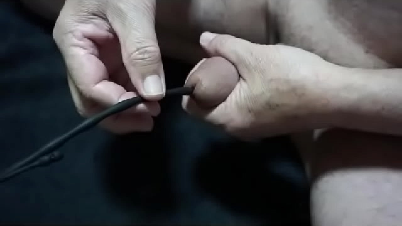 Inserting a silicone plug into the urethra