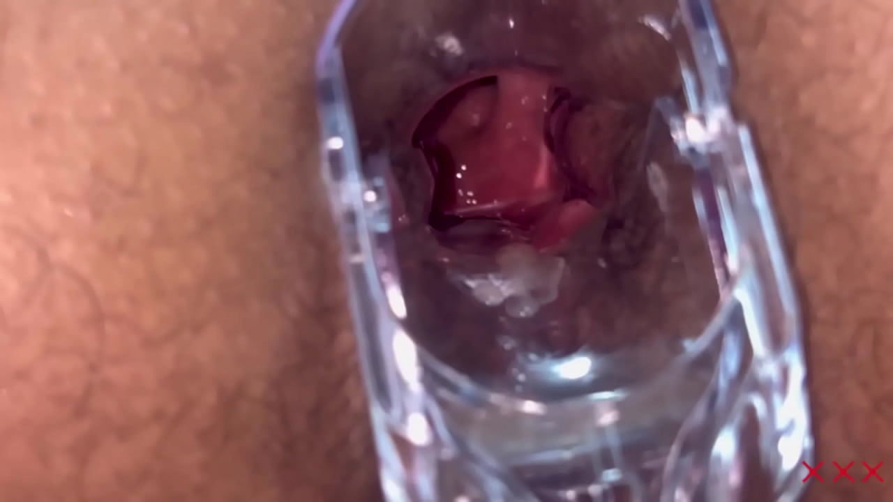 Anal Vision Speculum