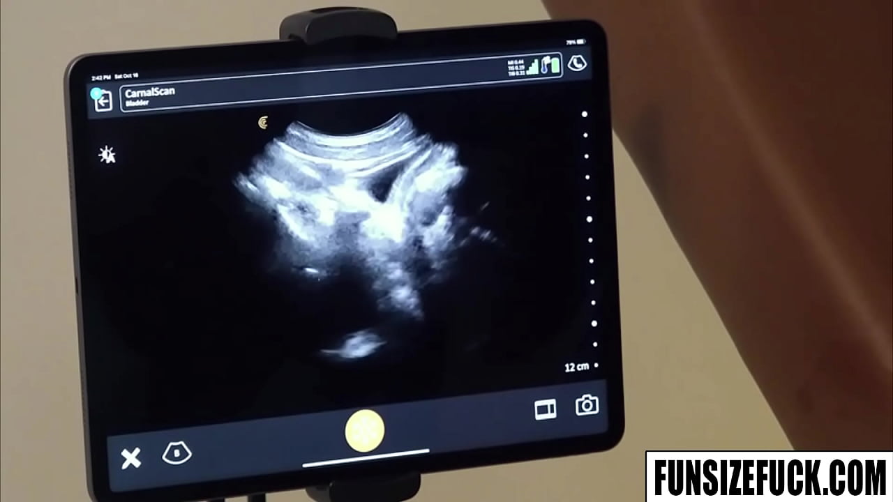 Joshua Oaks ASSFUCKED with ULTRASOUND Imagery