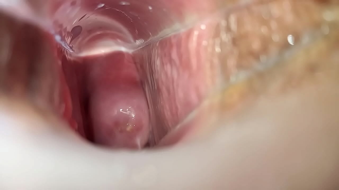 Speculum inside pussy