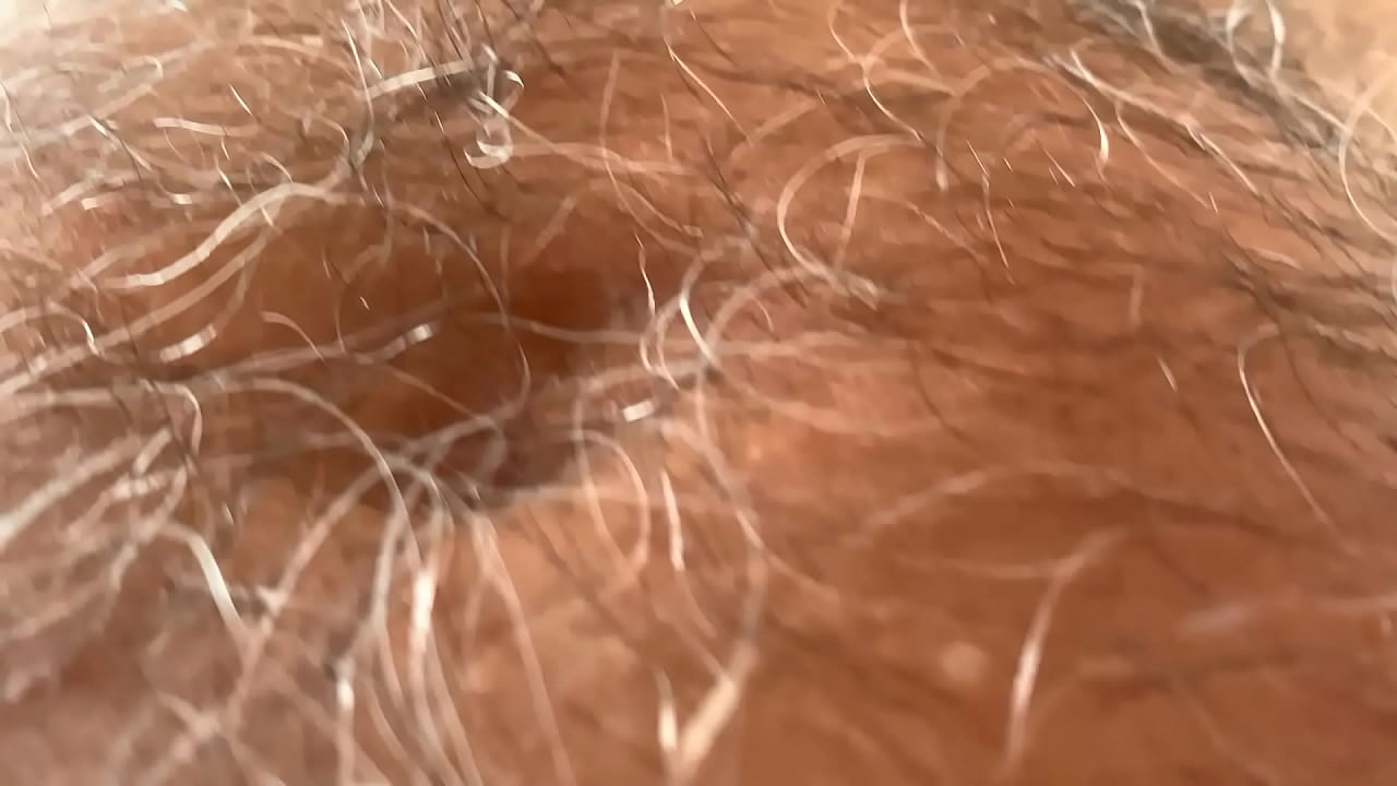 Very hairy man