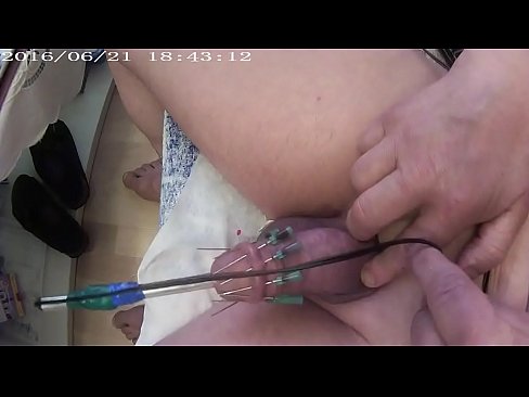 cbt insertion